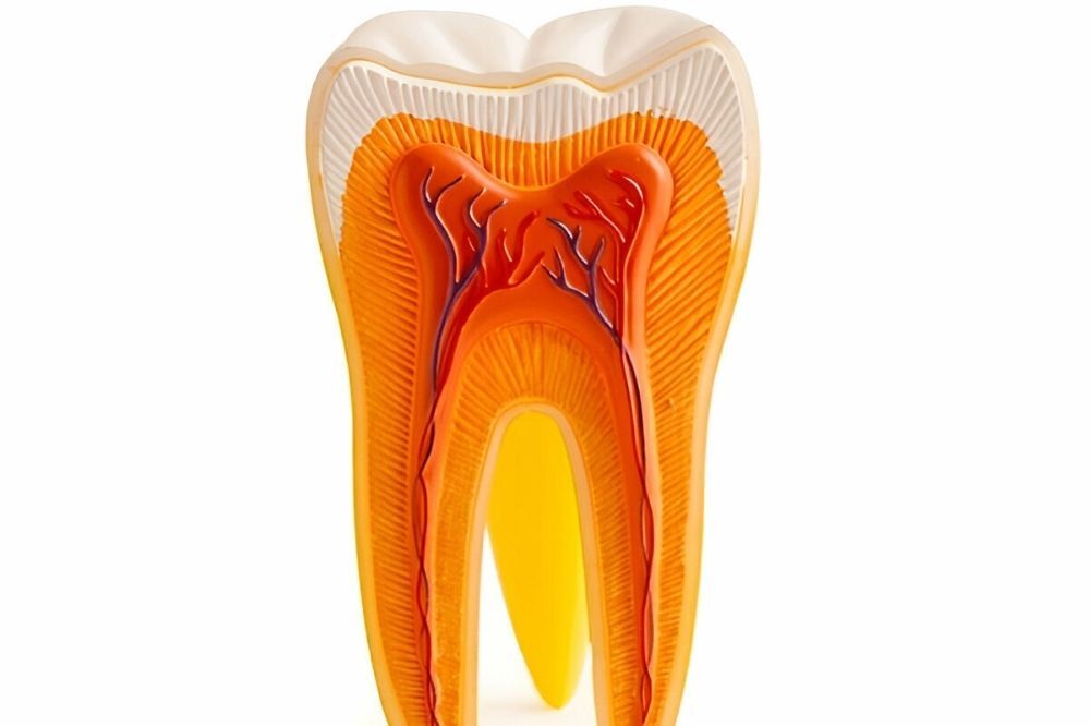 dental crowns in Saskatoon on a Root Canal Tooth?